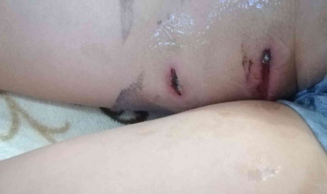 Başıboş köpeklerin saldırısından ölü taklidi yaparak kurtuldu