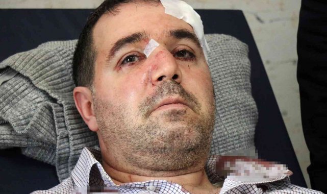 Doktoru darp ettiği iddiasıyla gözaltına alınmıştı, adli kontrolle serbest bırakıldı