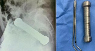 Makatına 2 kiloluk dambıl girdi!