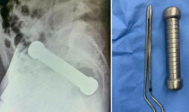 Makatına 2 kiloluk dambıl girdi!