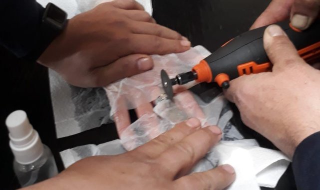 Parmağına sıkışan yüzüğü itfaiye çıkardı.