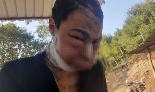 Yakalandığı hastalık kabusu olmuştu, hayatını kaybetti