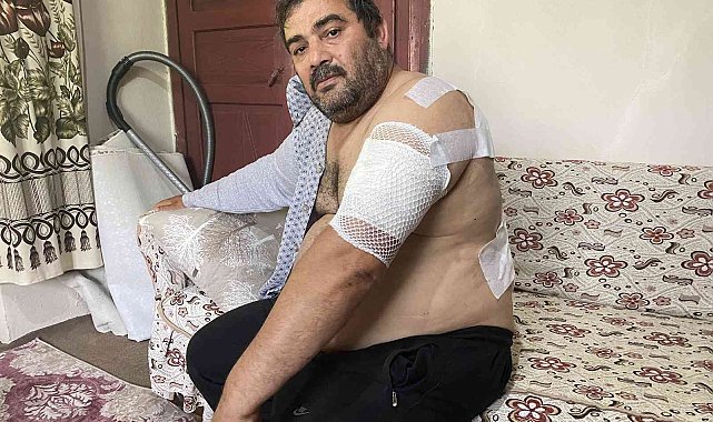 Ayı saldırısına uğrayan vatandaş: "Beni öldü zannetti"