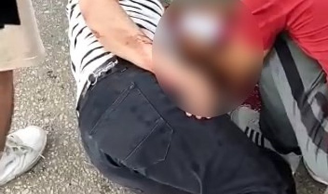 Bursa'da otomobile çarpan motosiklet sürücüsü kanlar içerisinde kaldı