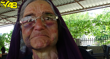 Kuzusunu sürüden almak isterken dayak yedi, yüzü tanınmaz hale geldi