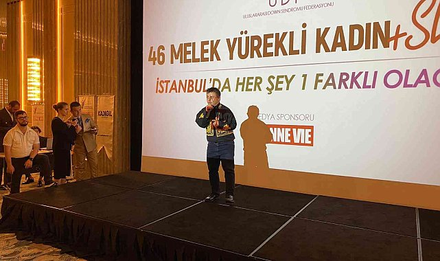 Down Sendromlu çocuklara destek