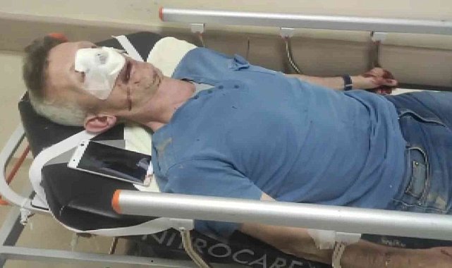 Sitedeki fahiş zam için eylem yaptı, yöneticiden dayak yedi