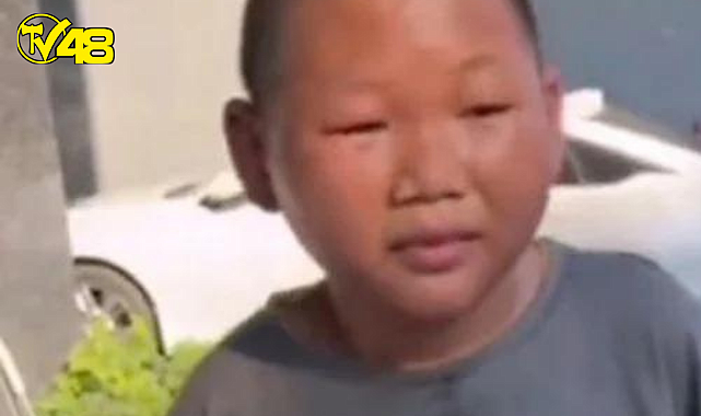 Dış görünüşünden dolayı iş bulamıyor 