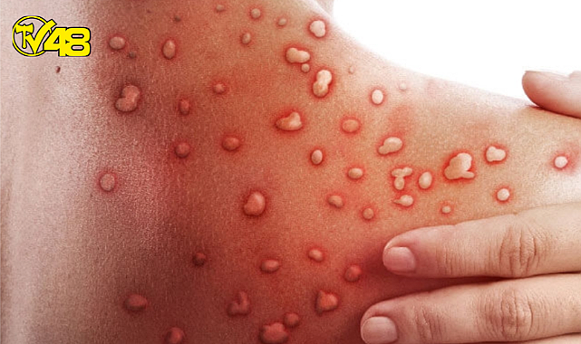 DSÖ&#039;den &#039;küresel acil durum&#039; ilanı! 