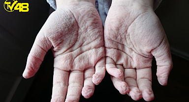 İşte Parmaklarınızın Buruşmasının Gerçek Nedeni?