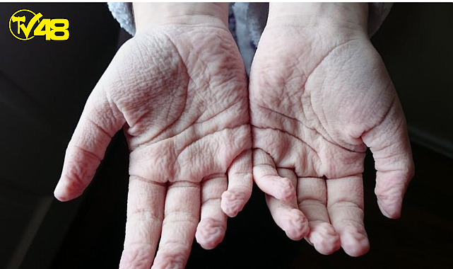 İşte Parmaklarınızın Buruşmasının Gerçek Nedeni?