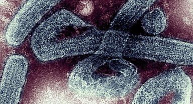 Marburg virüsü nedir, belirtileri nelerdir, nasıl bulaşır?