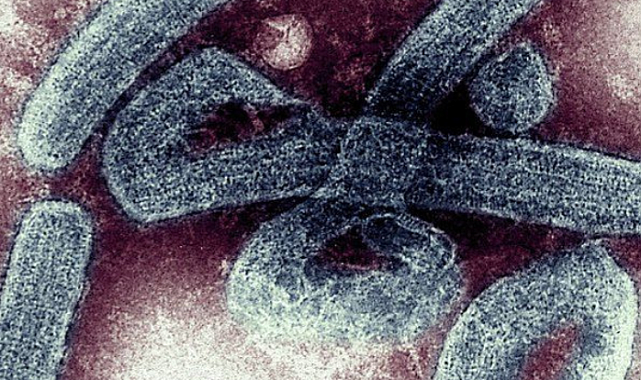 Marburg virüsü nedir, belirtileri nelerdir, nasıl bulaşır?