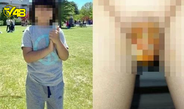 Yanlış sünnet iddiası !