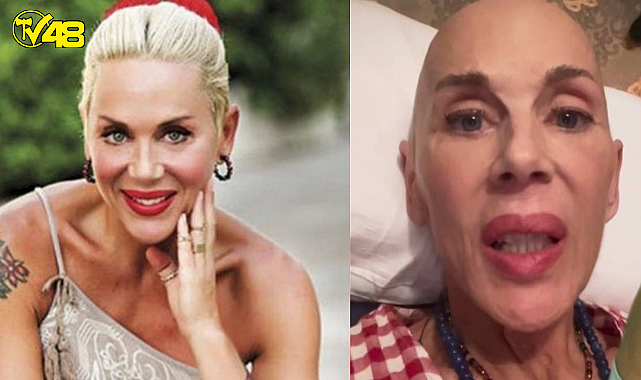 Akciğer kanseri ile mücadele eden Billur Kalkavan  &#039;&#039;zatürre oldum nefes almakta biraz zorlanıyorum...&quot;