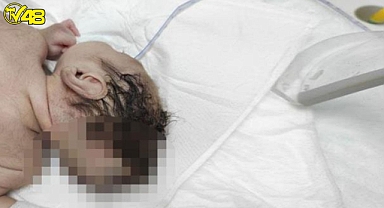 Beyni kafatasının dışında doğdu!