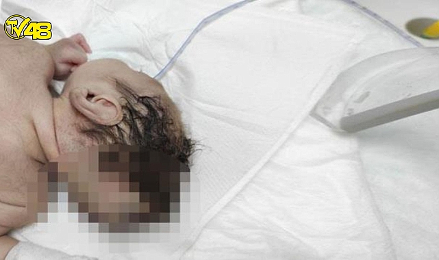 Beyni kafatasının dışında doğdu!