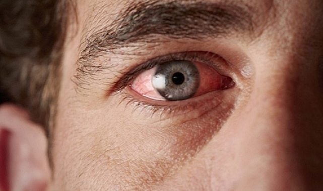 Görme Kaybına Neden Olan Hastalıklara Aman Dikkat !