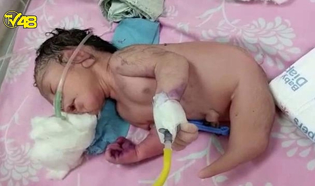 Hindistan&#039;da doğan bebek doktorları şoke etti !