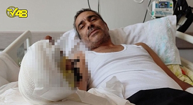 Kopan parmaklarını poşete koyup hastanenin yolunu tuttu