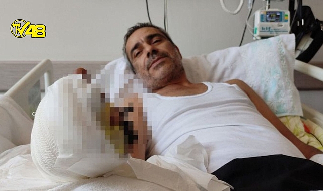 Kopan parmaklarını poşete koyup hastanenin yolunu tuttu