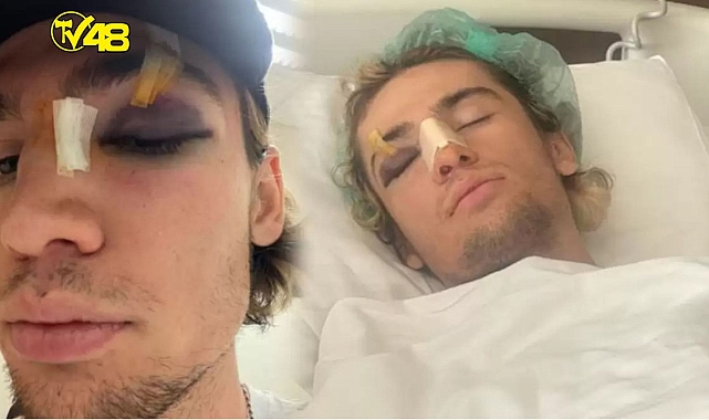 MİLLİ SPORCUYU ANTRENMAN YAPARKEN TANINMAZ HALE GETİRDİLER!