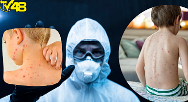 Yeni salgın alarmı: Domates gribi (Domates gribi belirtileri neler?, bulaşıcı mı? tedavisi var mı?)