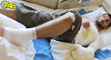 Epilepsi nöbeti geçirirken, kaynayan çorba kazanına düştü