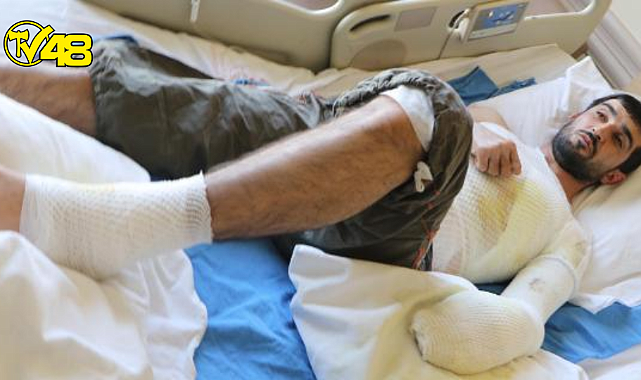 Epilepsi nöbeti geçirirken, kaynayan çorba kazanına düştü