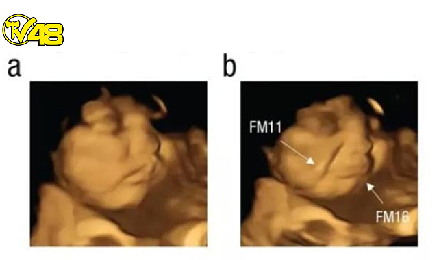Hamile kadına yedirilen lahanaya bebeğin tepkisi şaşkına çevirdi! ultrason kamerasına yansıdı