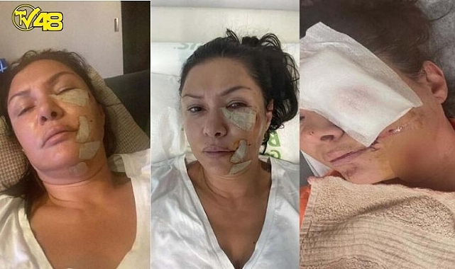 TUĞBA ALTINTOP&#039;A KÖPEK SALDIRDI!