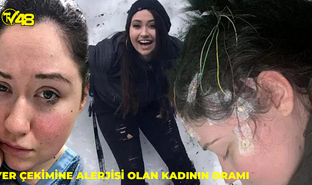 &#039;Yer çekimi&#039; alerjisi var!