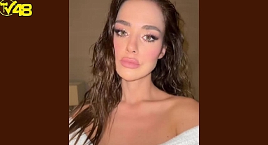 Doğrulanmış "DOĞAL HALİ ÇOK GÜZELDİ" Bensu Soral, estetik modasına uydu.