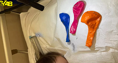 Gaziantep'te akılalmaz olay! 1 yaşındaki bebeğin midesinden 3 balon çıkarıldı .