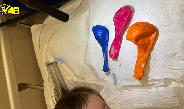 Gaziantep&#039;te akılalmaz olay! 1 yaşındaki bebeğin midesinden 3 balon çıkarıldı .