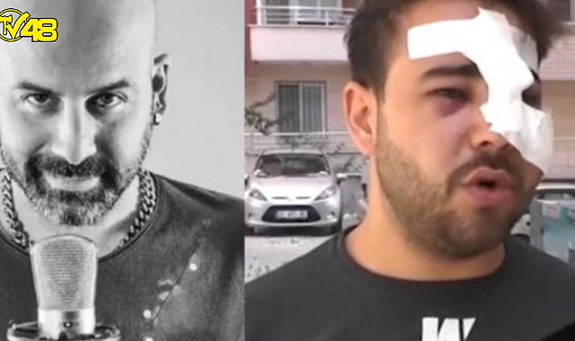 İkinci Onur Şener vakası! İstek parçayı bilmediği için çalamadı diye yüzünde şişe parçaladılar