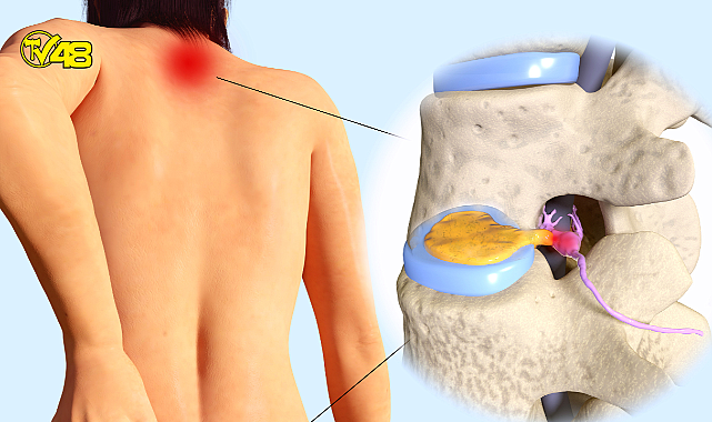 BUNLAR FITIK BELİRTİSİ OLABİLİR!