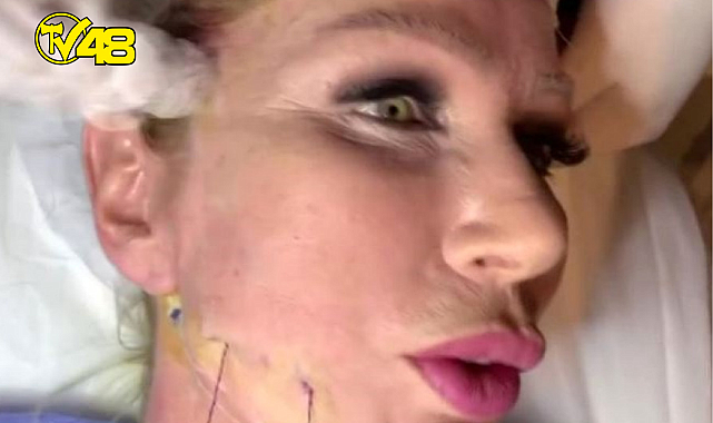 SEDA SAYAN ESTETİK YAPTIRMAYA DOYAMIYOR!