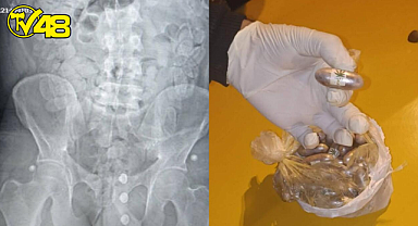 1,5 kilo reçine esrarı yutarak Fas'tan Türkiye'ye getirdi! Kokusu ele verince yakalandı