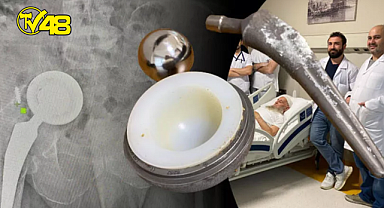 Doktorları dinlemedi, kalça protezi karnından çıktı!