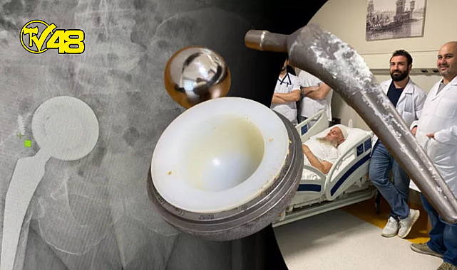 Doktorları dinlemedi, kalça protezi karnından çıktı!