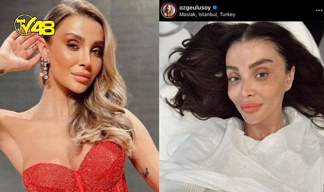 Ünlü manken Özge Ulusoy&#039;un yüzünün son hali takipçilerini üzdü: İnsan bunu kendine neden yapar?
