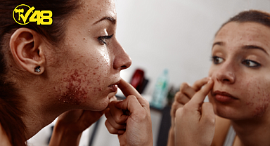 SAĞLIKLI VE GÜZEL CİLT İÇİN BUNLARA DİKKAT