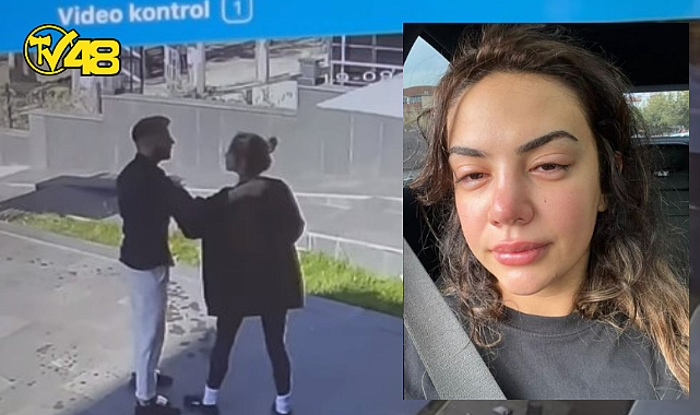 ESKİ EŞİNDEN ŞİDDET GÖRDÜĞÜNÜ SÖYLEYEN ŞARKICI ECE RONAY, SOSYAL MEDYADAN YARDIM İSTEDİ.