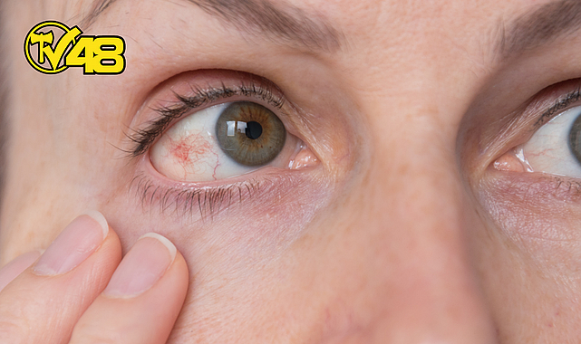 GÖZÜNÜZÜN TANSİYONUNA DİKKAT!