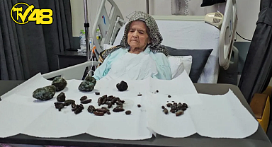 MİDESİNDEN 35 ZEYTİN VE 28 HURMA İLE 5 TAŞ ÇIKTI