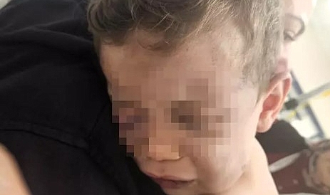 AREN BEBEĞİ ÖLDÜRESİYE DÖVEN CANİDEN MİDE BULANDIRAN İFADE