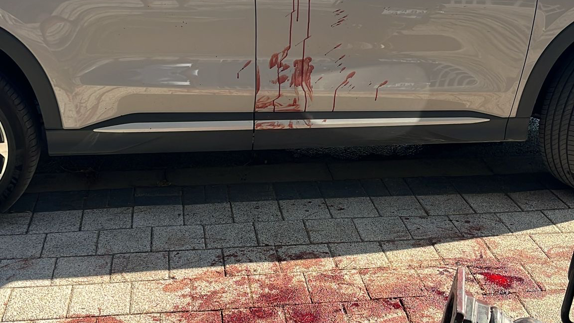 Bodrum Gündoğan’da Silah Sesleri: Yaralılar Var