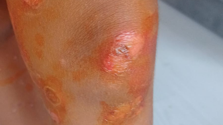 Zeytinlikuyu Plajı’nda Tehlike Mi Var?