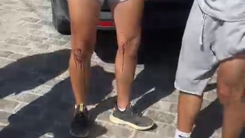 Milas Hayıtlı Mahallesi’nde Motosiklet Kazası: 3 Yaralı